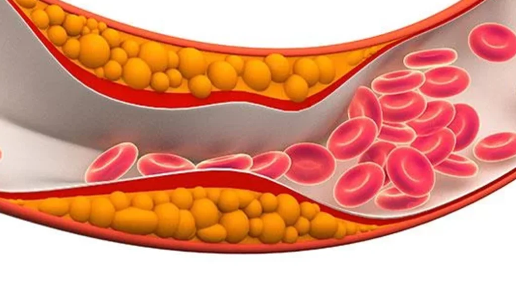 Colesterol e Triglicerídeos